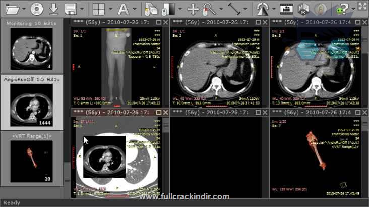 radiant-dicom-viewer-20231-x64-tam-surum-indir